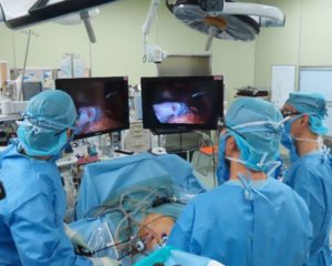 ハイビジョン3Dシステムを用いた腹腔鏡下胃切除術